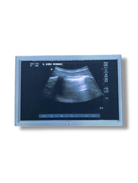Mini Echocardiogram / Ultrasound Play Tool