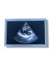 Mini Echocardiogram / Ultrasound Play Tool