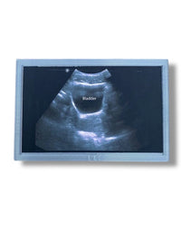 Mini Echocardiogram / Ultrasound Play Tool