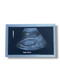 Mini Echocardiogram / Ultrasound Play Tool
