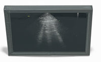 Mini Echocardiogram / Ultrasound Play Tool