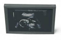 Mini Echocardiogram / Ultrasound Play Tool